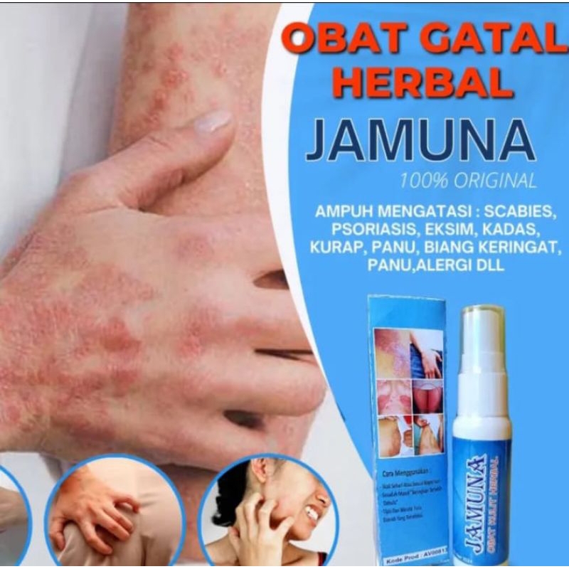 OBAT GATAL AMPUH 7 HARI  JAMUNA SPRAY Obat Gatal Seluruh Tubuh Herbal Dan Ampuh BPOM ORIGINAL