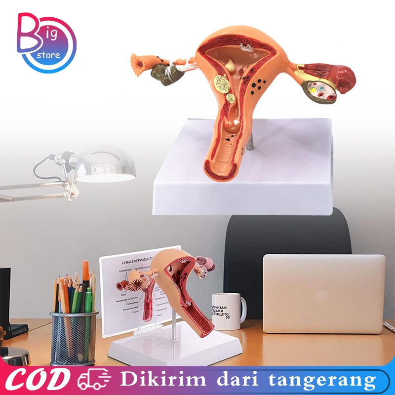 Uterus Ovary Anatomical Model Anatomy Alat Peraga Anatomi Model Patologis Uterus Ovarium Manekin Rah