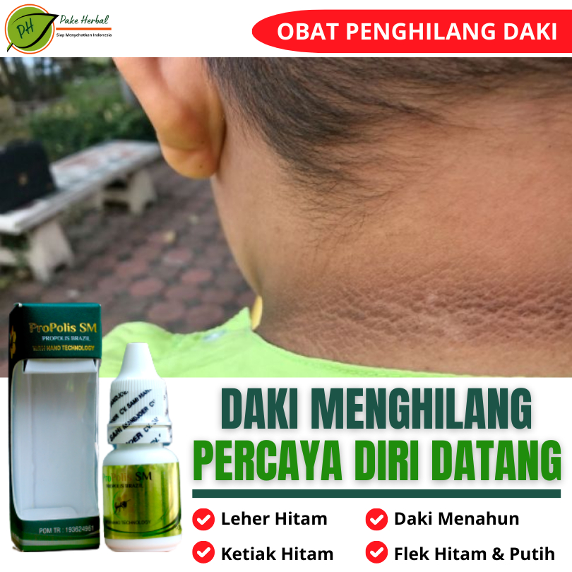 Obat Perontok Daki Penghilang Daki Pembersih Daki / Daki Di Leher / Daki Menahun / Daki Membandel / 