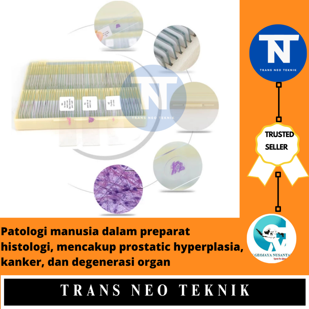 Patologi manusia dalam preparat histologi, mencakup prostatic hyperplasia, kanker, dan degenerasi or