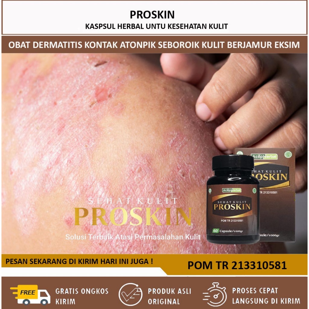 Obat Dermatitis Kontak, Atonpik, Seboroik - Proskin Sehat Kulit Obat Dermatitis Herbal Alami