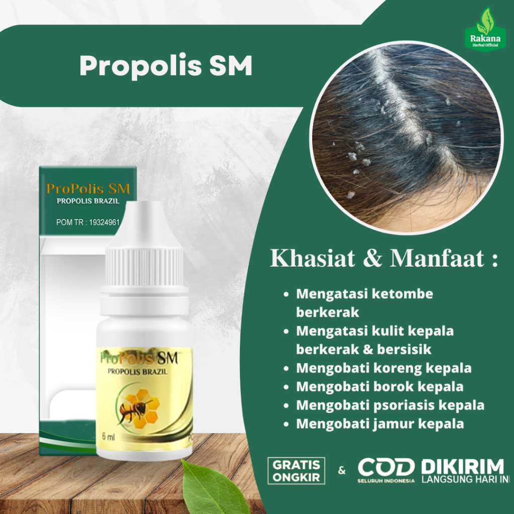 Obat Tetes Ketombe Kerak Kulit Kepala Gatal Bersisik Penghilang Koreng Borok Di Kepala Psoriasis Kep