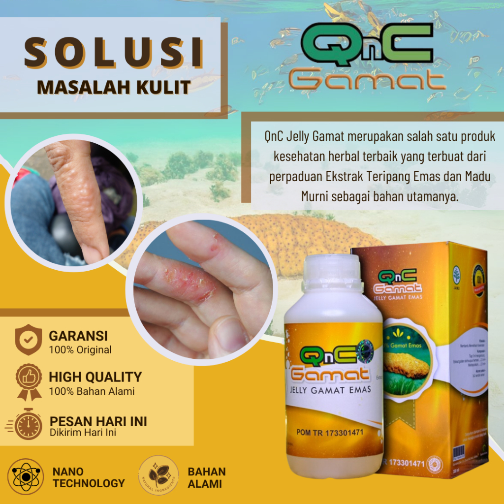 Obat Gatal Berair, Obat Gatal Kulit Menahun, Obat Darah Manis, Obat Gatal Berair di Jari Tangan dan 