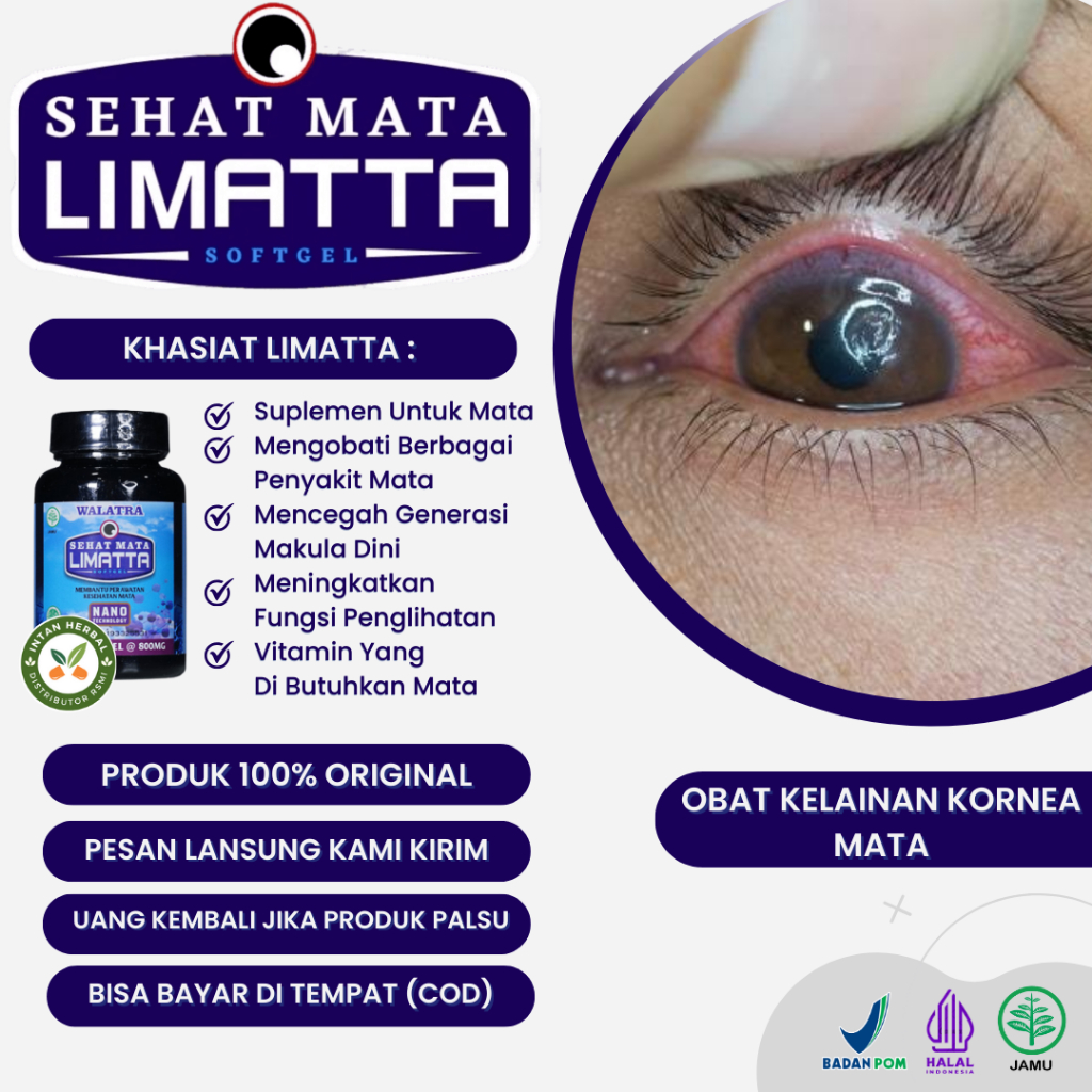 Limatta 30 Sofgel - Obat Kelainan Kornea Mata, Radang Kornea Mata, Kornea Mata Keruh, Infeksi Kornea