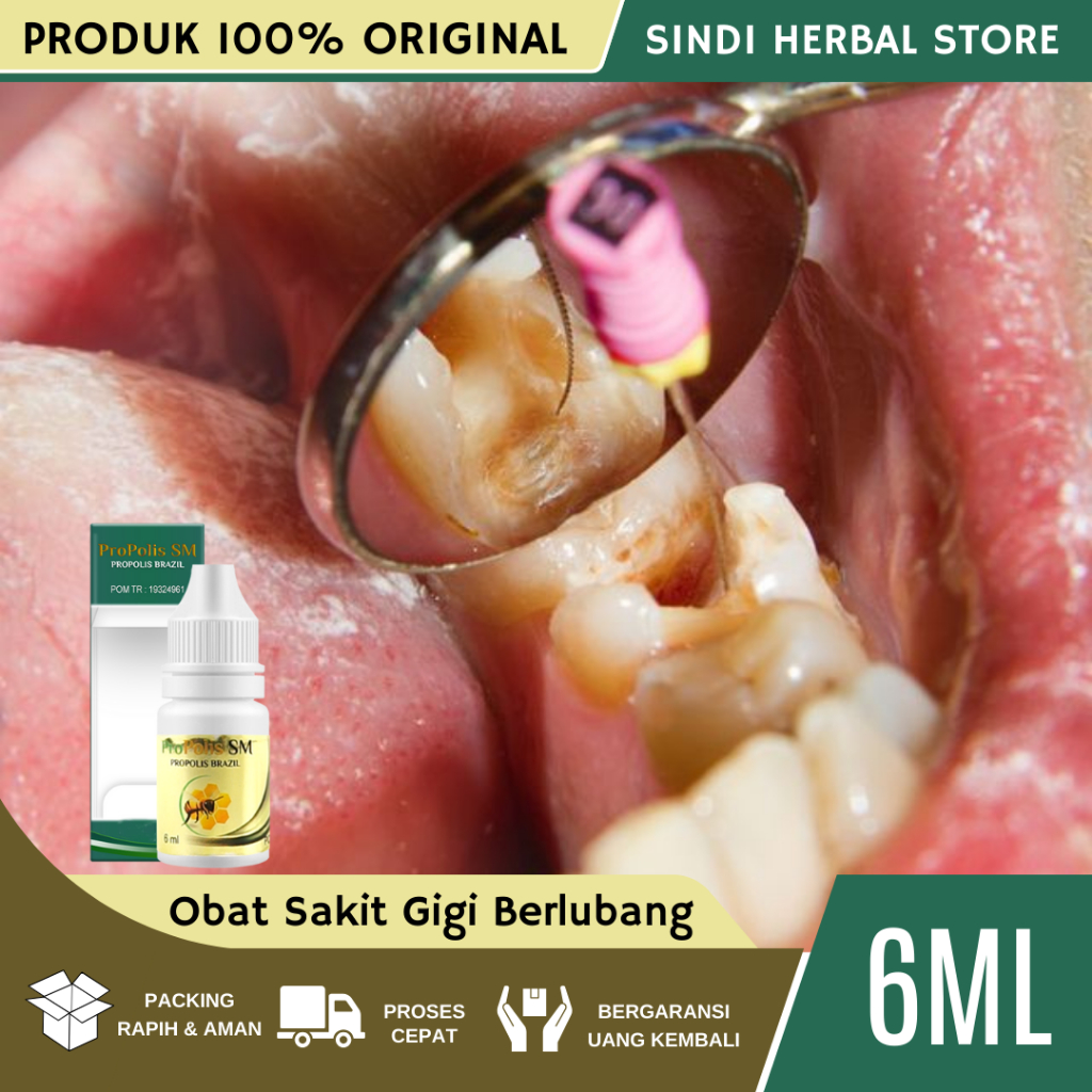 Obat Sakit Gigi Berlubang, Obat Gigi Berlubang, Obat Penghilang Sakit Gigi Berlubang, Obat Gigi Bolo