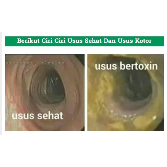 

RB22 [VARIAN] Original Senna Leaf Annafis Superfood Daun Senna Membersihkan Usus Detox Usus