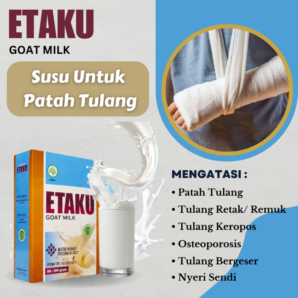 Susu Untuk Patah Tulang, Penyambung Tulang Patah, Susu Untuk Tulang Retak/ Remuk, Susu Pengapuran Tu