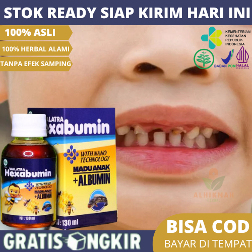 Obat Penumbuh Gigi Anak, Obat Gigi Ompong Anak, Obat Mempercepat Pertumbuhan Gigi Anak, Vitamin Agar