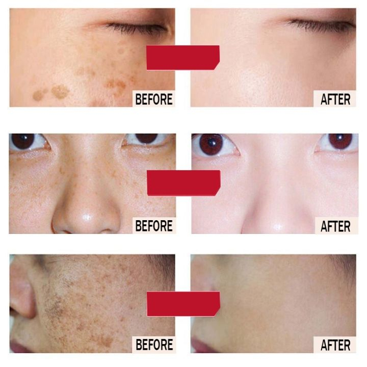 Krim Wajah EBUG Whitening and Freckle Removal Cream Pelembab Pemutih Penghilang Flek Bintik Hitam