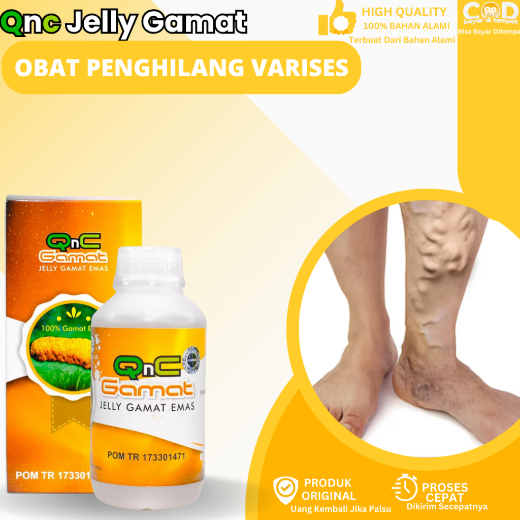 Obat Penghilang Urat Varises, Obat Varises Di Kaki, Penghilang Varises Bengkak, Obat Varises Di Beti