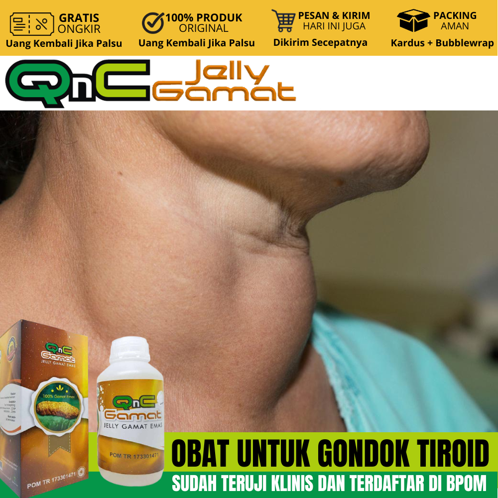 Obat Herbal Untuk Gondok, Obat Herbal Gondok Beracun, Gondok Dalam, Gondok Di Leher, Kelenjar Gondok