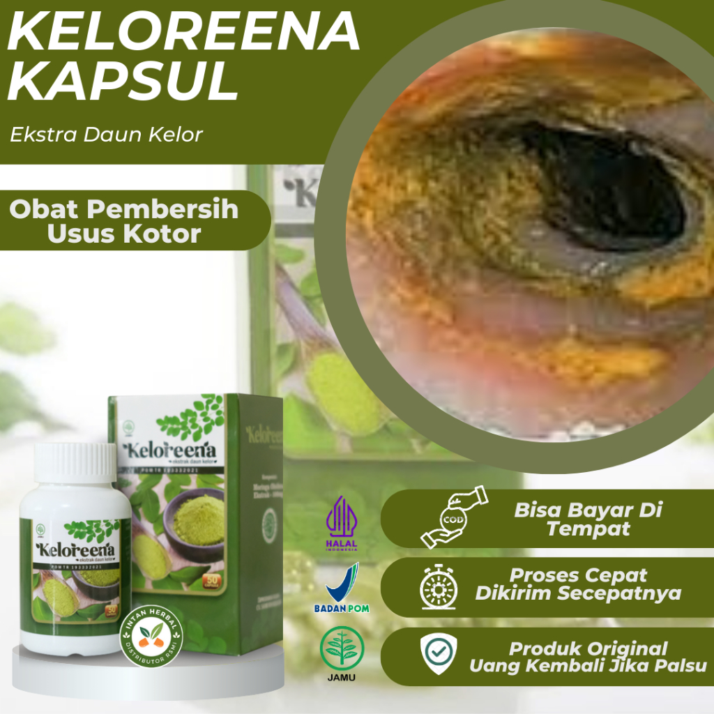 Keloreena Kapsul 100% Original - Obat Pembersih Usus Kotor, Detoksifikasi Usus, Iritasi Luka Usus, I