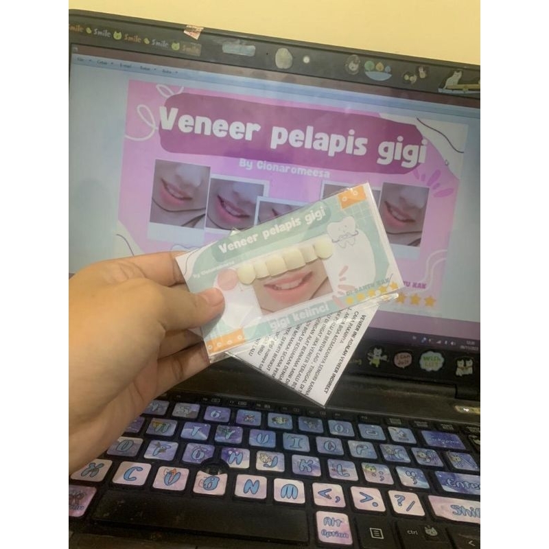 veneer pelapis gigi kelinci pelapis super elastik di duni