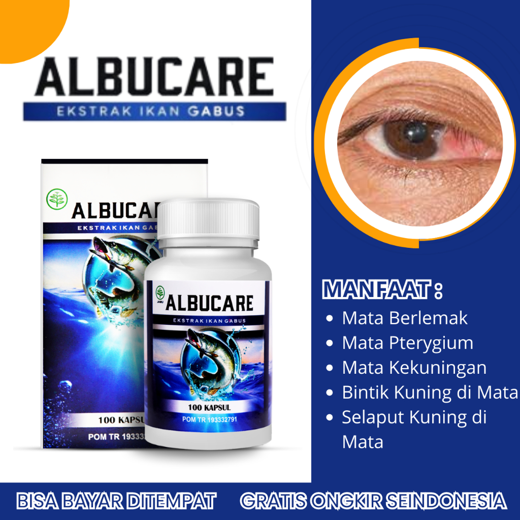 Obat Kesehatan Mata, Obat Mata Berlemak, Obat Mata Kekuningan, Obat Mata Pterygium, Obat Bintik Kuni