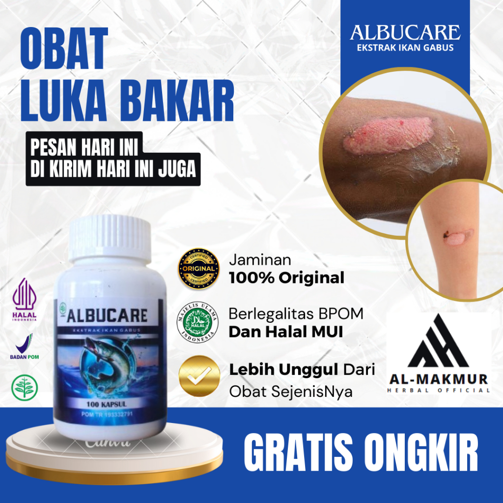 Obat Luka Bakar, Obat Luka Bakar Melepuh, Obat Kulit Berair, Obat Kulit Tersiram Minyak Panas, Tersi