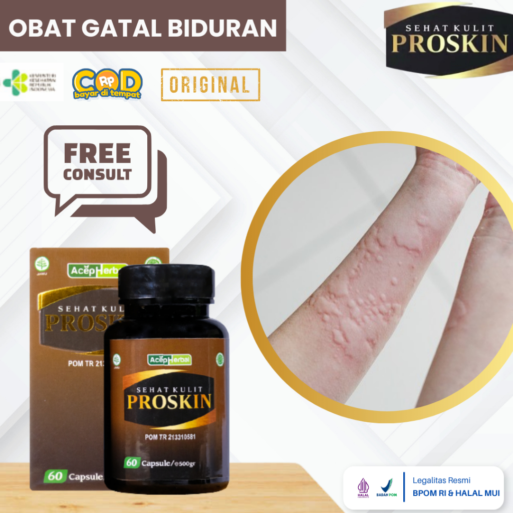 Obat Biduran, Obat Gatal Biduran, Obat Alergi Dingin, Obat Kaligata, Obat Gatal Seluruh Tubuh, Obat 
