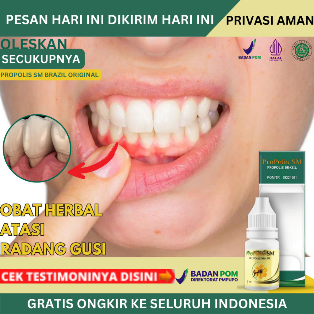 Obat Radang Gusi, Gusi Bengkak Dan Sakit, Gusi Berdarah, Resesi Gusi, Gusi Turun, Gusi Bernanah, Gig