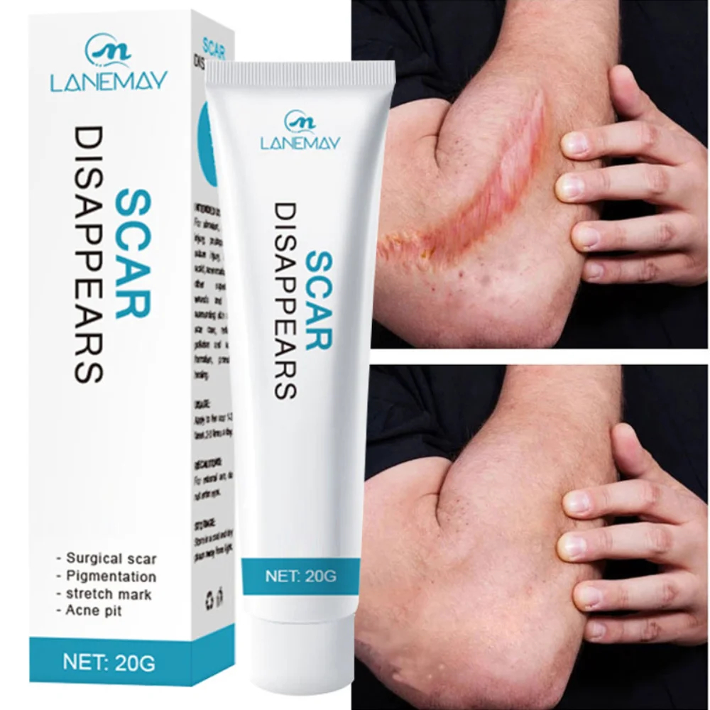 【100%ORI】20gPenghilang bekas luka Scar Remover Cream Salep penghilang bekas luka hitam Penghilang be