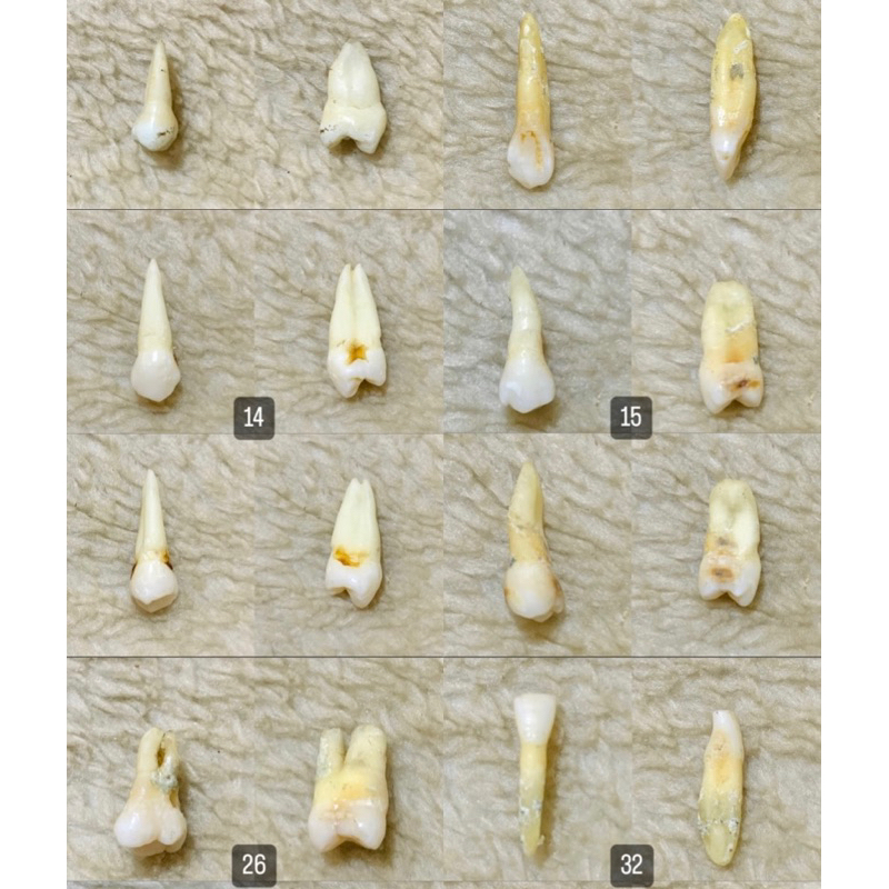 Gigi Asli / Gigi Asli Praktikum / Gigi insisivus caninus molar premolar