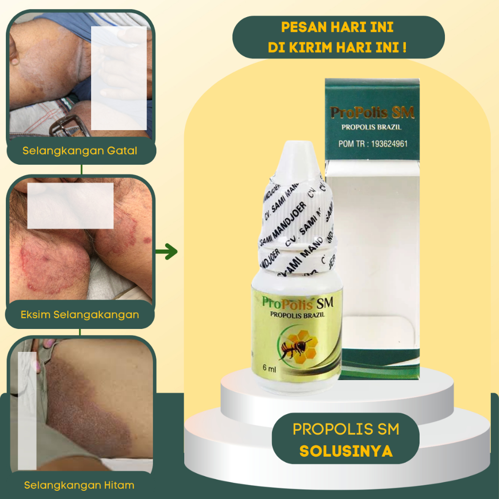 *PRIVASI* Obat Selangkangan Gatal Hitam Lecet - Kurap Selangkangan Eksim - Selangkangan Lecet - Obat