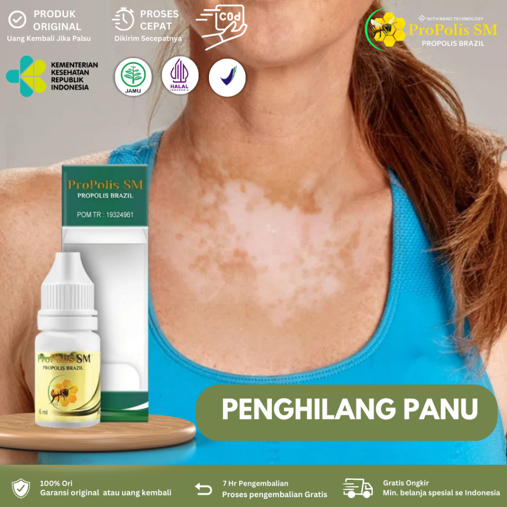 Obat Penghilang Panu, Obat Jamur Kulit Anak dan Dewasa, Obat Panu Anak Dan Dewasa, Penghilang Panu, 