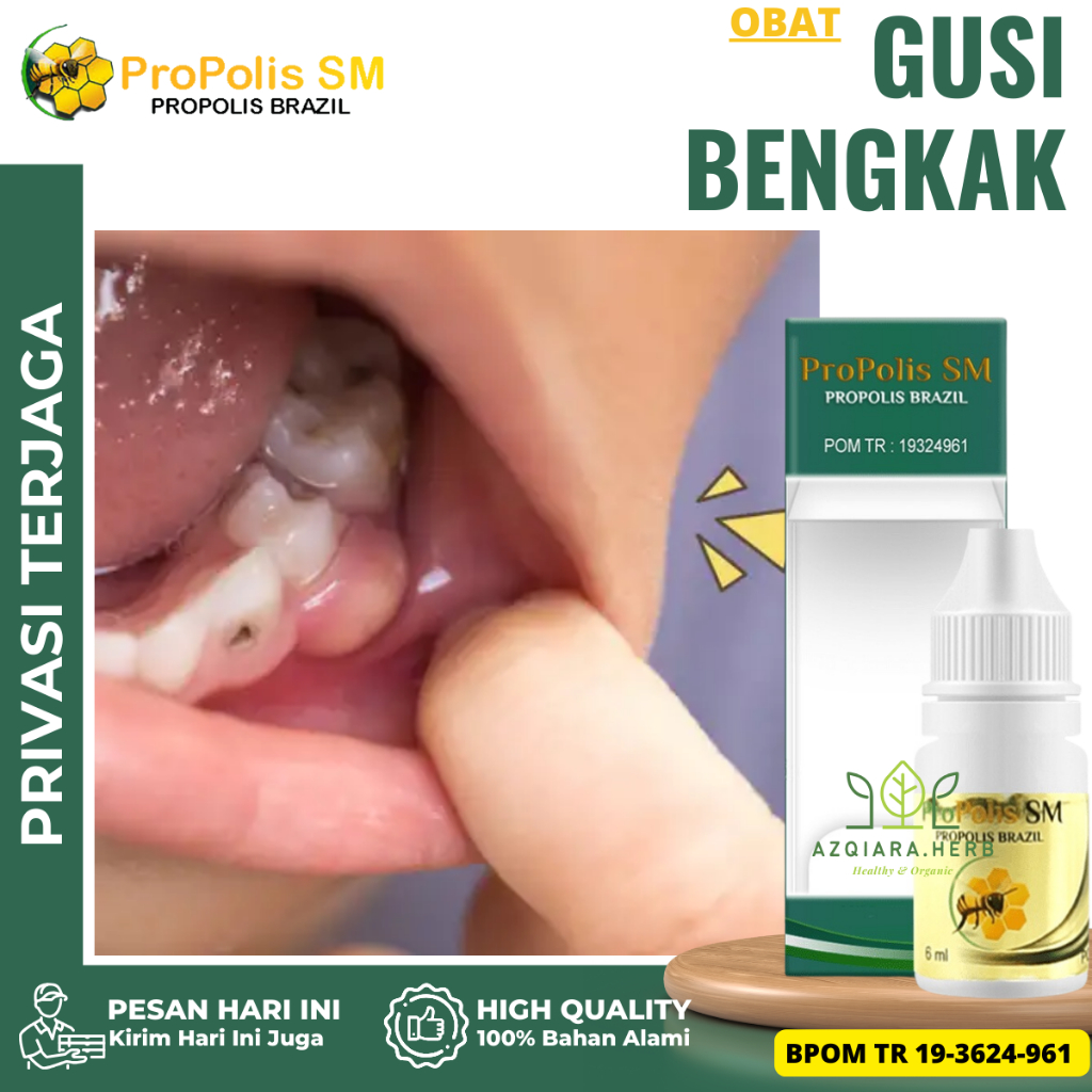 Obat Gusi Bengkak, Obat Gusi Turun, Obat Tetes Abses Gusi, Obat Radang Gusi, Obat Gusi Berdarah, Oba