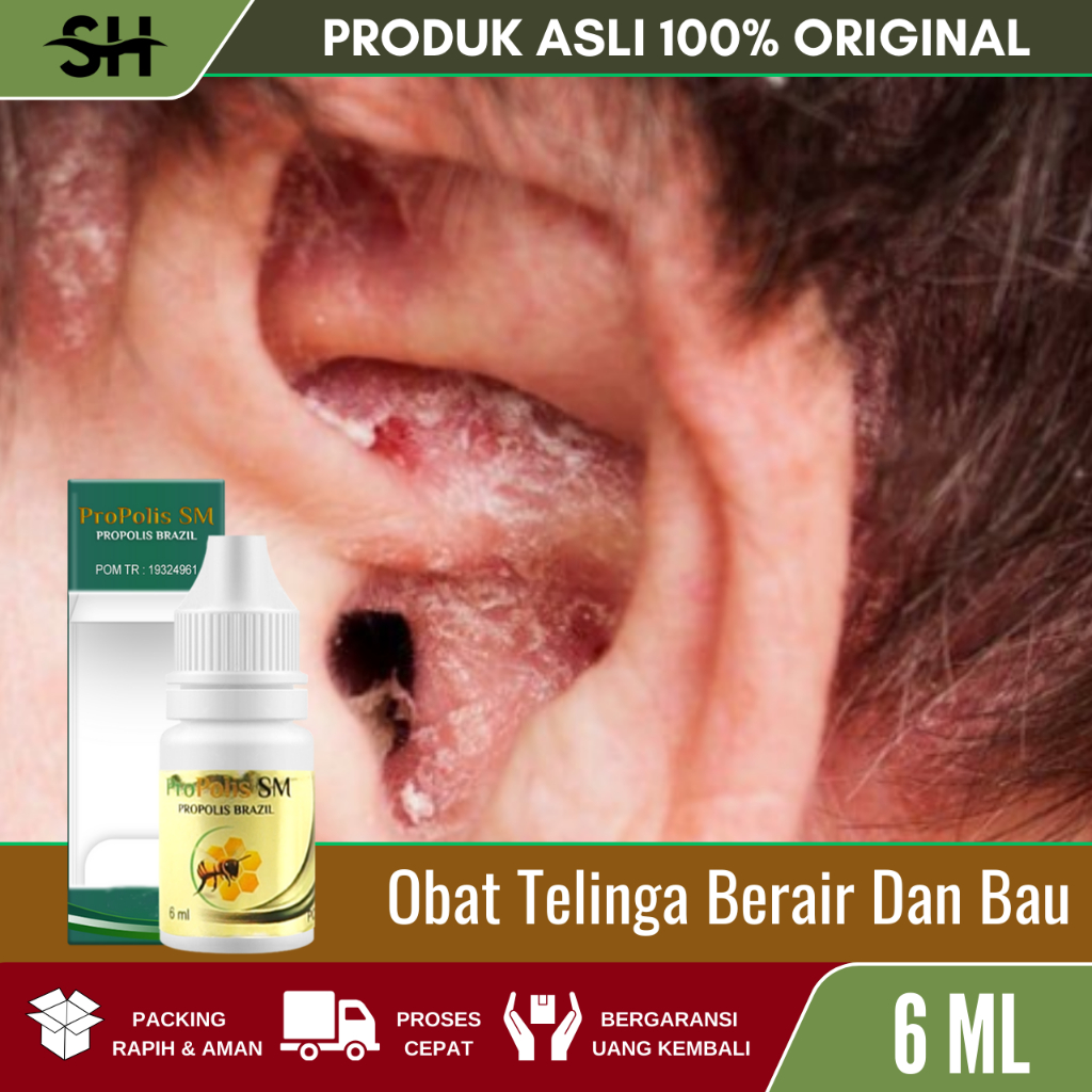 Obat Tetes Telinga Berair dan Bau, Kuping Gatal, Obat Curek Untuk Anak dan Dewasa, Obat Infeksi Teli