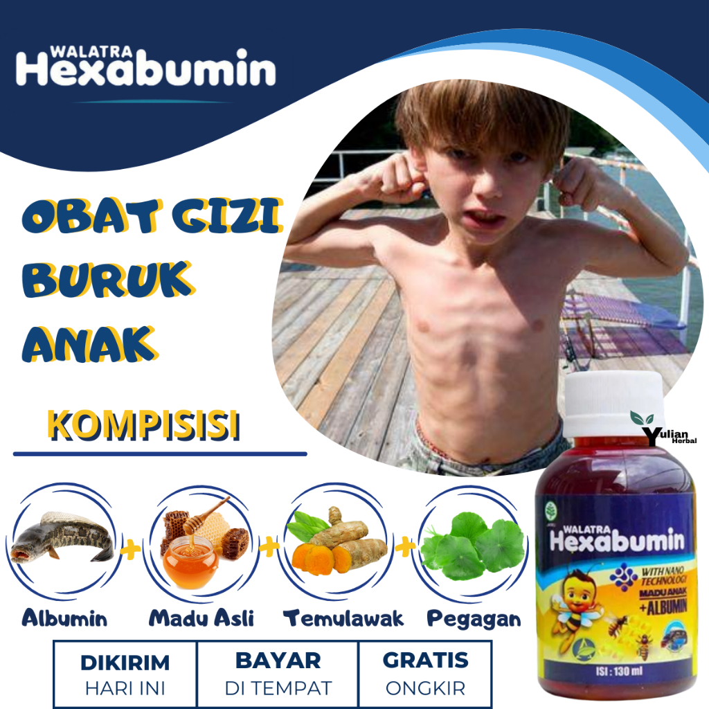Obat Gizi Buruk Anak, Madu Penambah Gizi Anak, Vitamin Penambah Gizi Anak, Nutrisi Pencegah Gizi Bur
