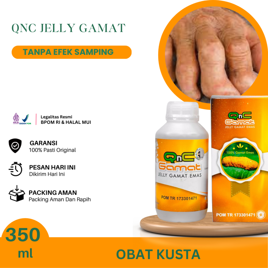 Obat Kusta, Kusta Basah/ Kering, Kusta Di Wajah, Kusta di Kaki, Kusta di Tangan, Infeksi Jamur Kulit