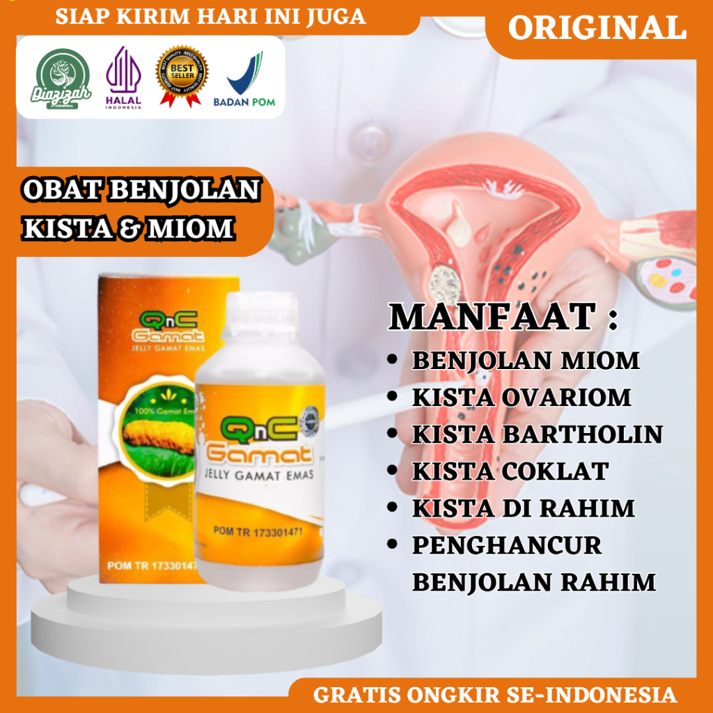 Obat Kista, Obat Miom, Obat Kista Ovarium, Obat Kista Endometriosis, Obat Kista Bartholin, Obat Kank