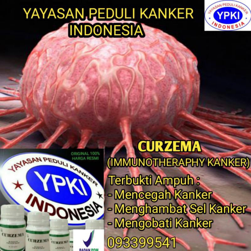 Curzema Asli Herbal Alami Obat Kista Ganglion Di Apotik Paling Ampuh