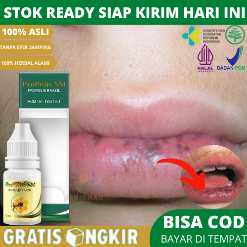 Obat Penghilang Bintik Hitam Di Bibir, Obat Bercak Hitam Di Bibir, Obat Alergi Kosmetik Bibir Terasa