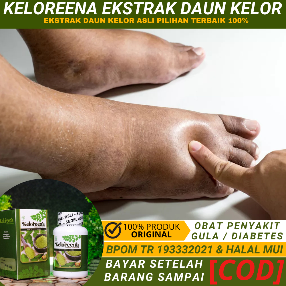 Obat Penyakit Gula, Penyakit Gula Kering, Penyakit Gula Basah, Penurun Diabetes, Penyakit Gula Darah