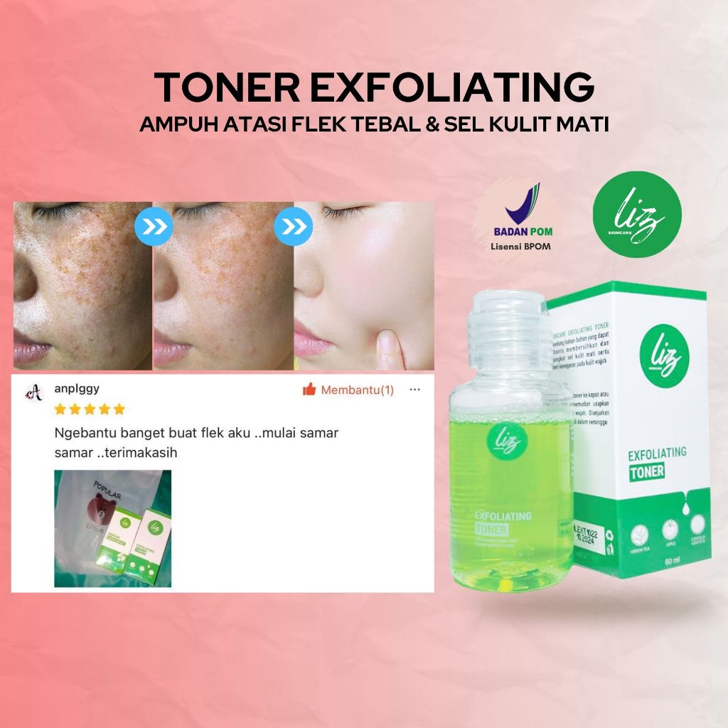 Elzet Skincare Exfoliating Toner BPOM Pengangkat Sel Kulit Mati Wajah Toner Pengelupasan Pemutih Waj