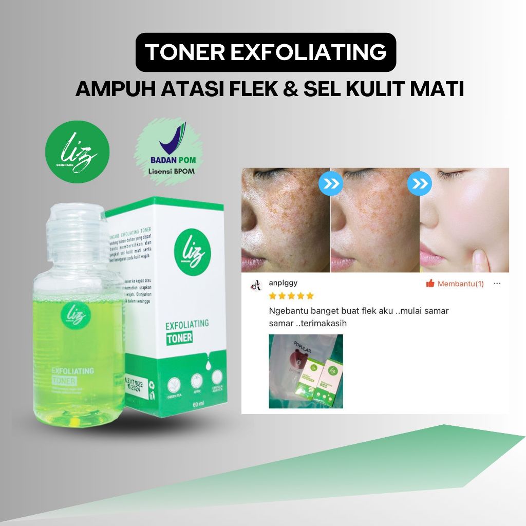 BPOM Elzet Skincare Exfoliating Toner Original Pengangkat Sel Kulit Mati Wajah Toner Pengelupasan Pe