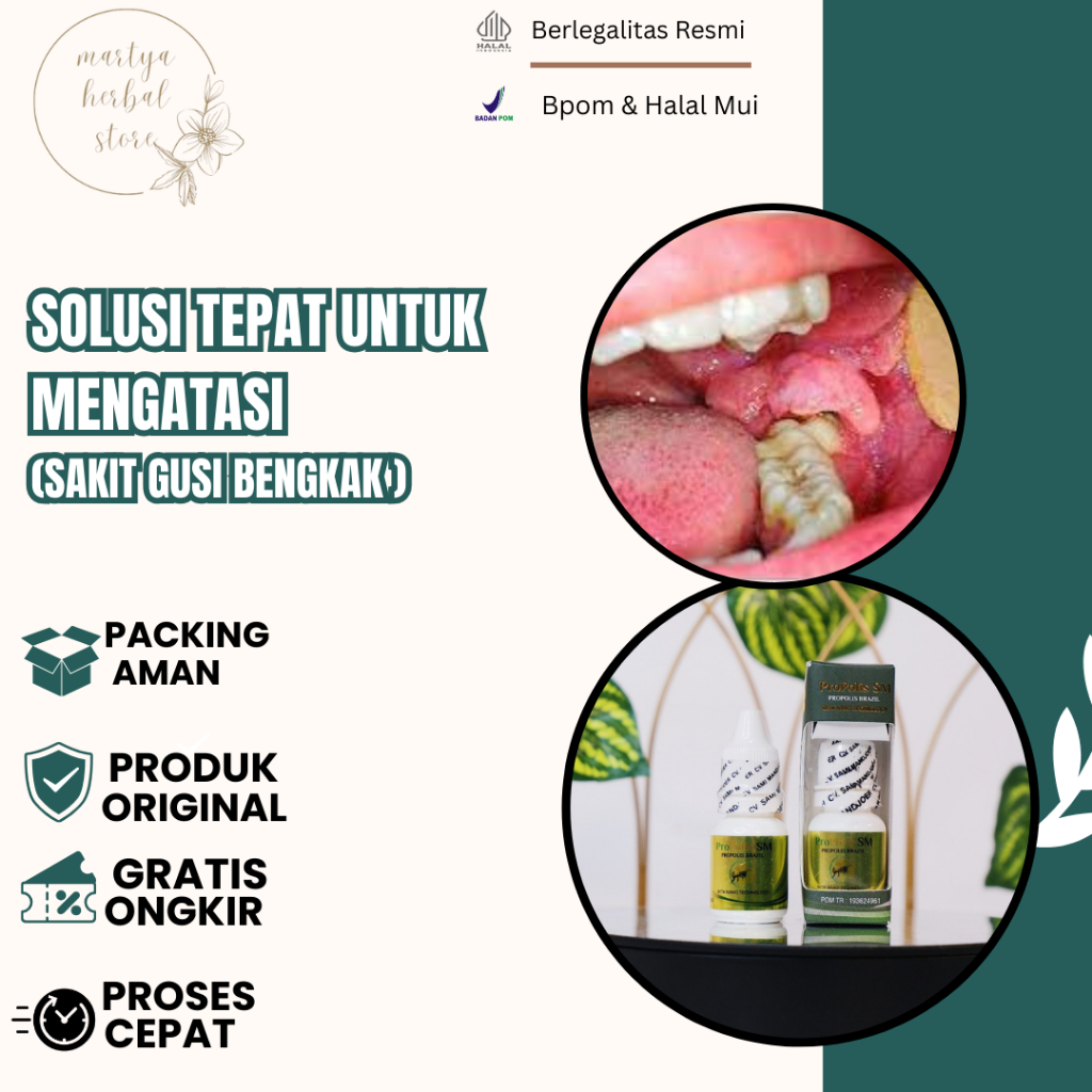 Obat Gusi, Obat Gusi Turun, Obat Gusi Bengkak, Obat Radang Gusi, Obat Nyeri Gusi, Obat Gusi Berdarah