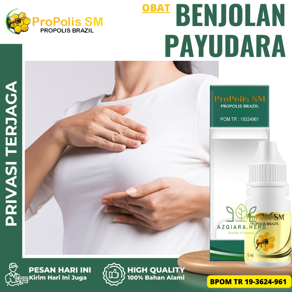 Obat Benjolan di Payudara, Obat Herbal Penghancur Benjolan Payudara, Obat Benjolan Lipoma Di Payudar