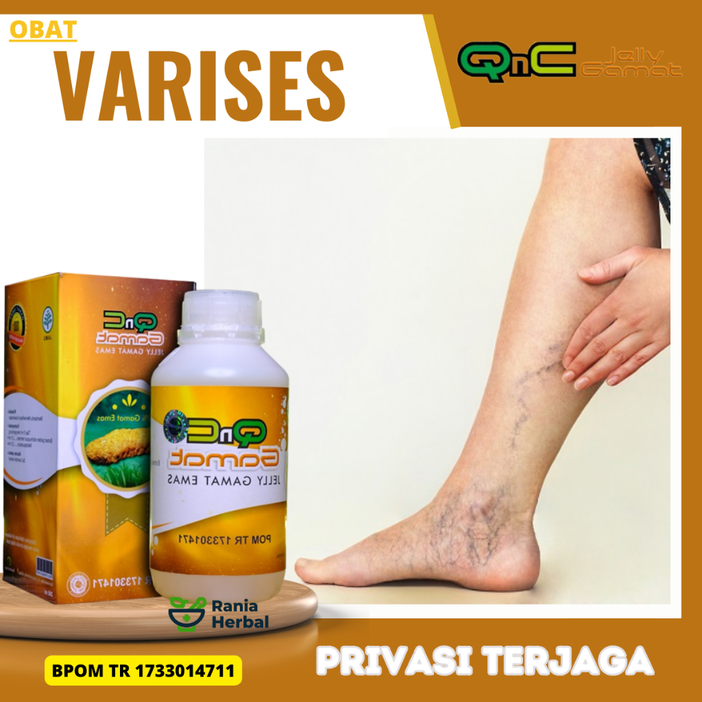 Obat Varises, Obat Varises Urat Betis Menonjol, Obat Varises Di Kaki, Obat Varises Pelancar Pembuluh