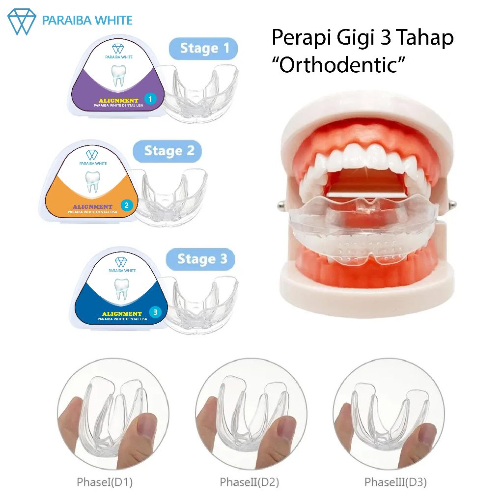 Perapi Gigi - Teeth Trainer Allignment - Orthodentic Retainer - Behel Kawat Gigi Transparan - Isi 3 