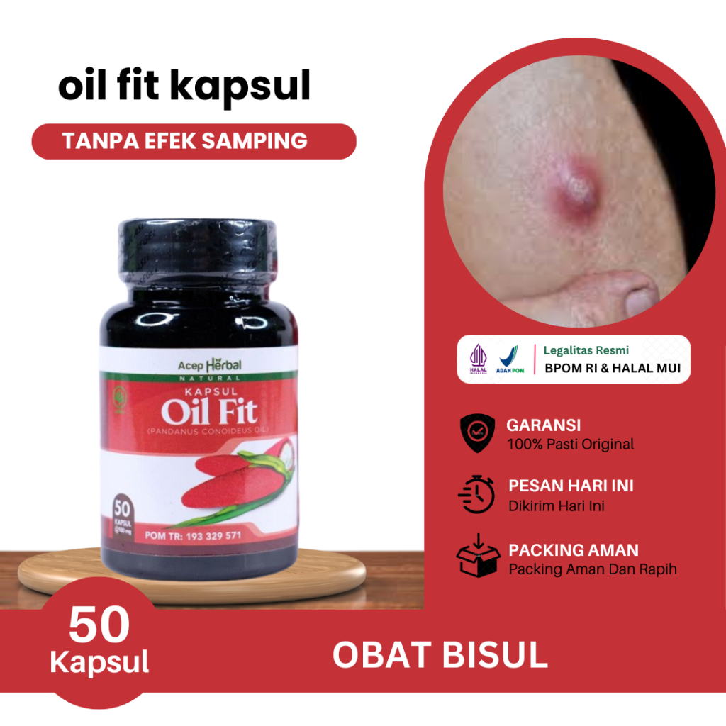 Obat Bisulan, Bisul Di Punggung, Di Ketiak, Di Pantat, Di Telinga, Bisul Bernanah, Mengempeskan Bisu