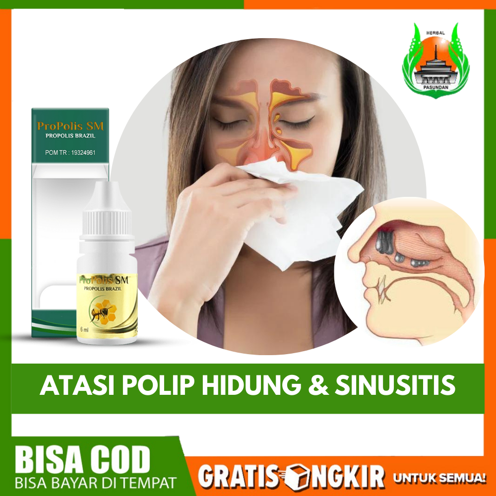 Obat Polip Hidung , Sinusitis , Hidung Meler, Benjolan di Dalam Hidung, Tumor Hidung, Hidung Mampet 