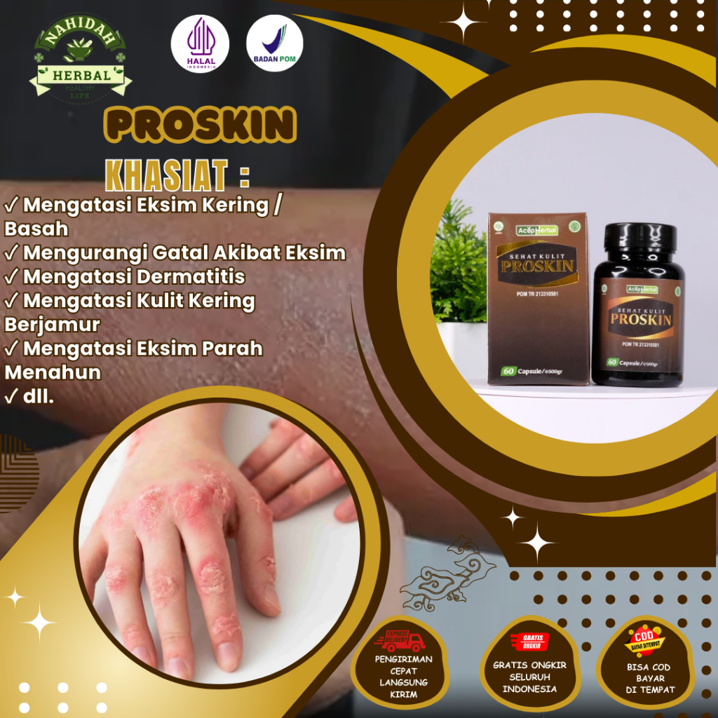 Obat Eksim, Obat Gatal Akibat Eksim, Obat Eksim Kering, Eksim Basah, Kulit Kering Berjamur, Luka Eks