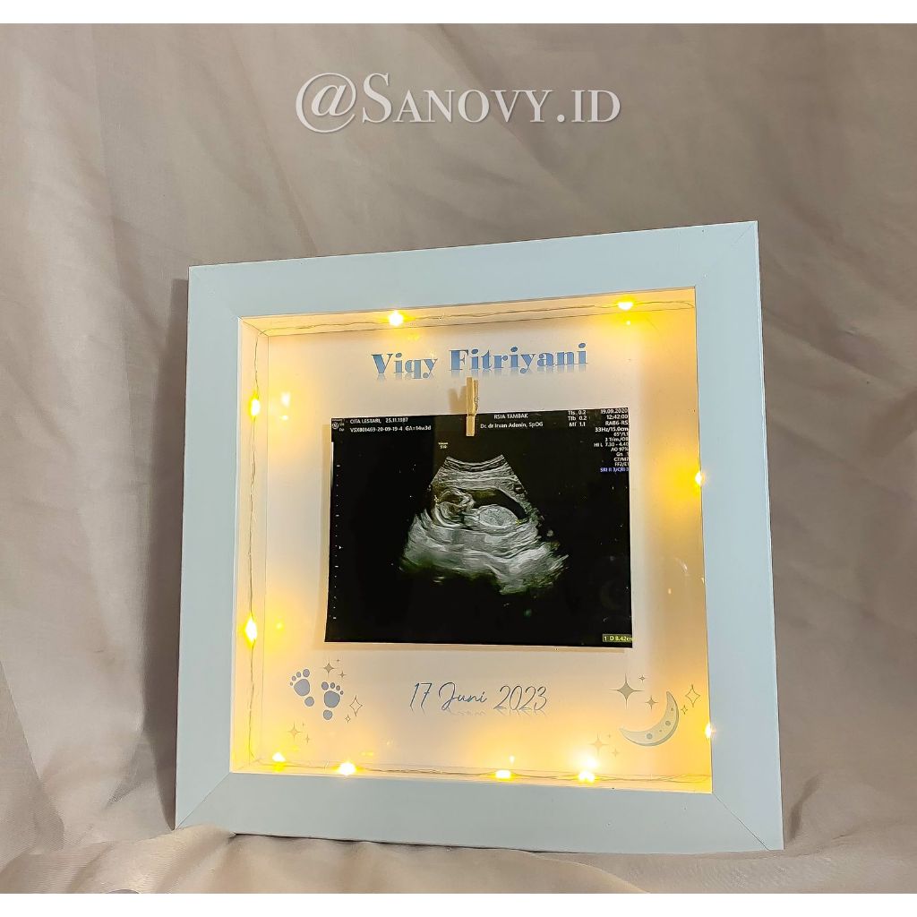 2020012 Pigura / frame 3d USG Baby Photo Frame