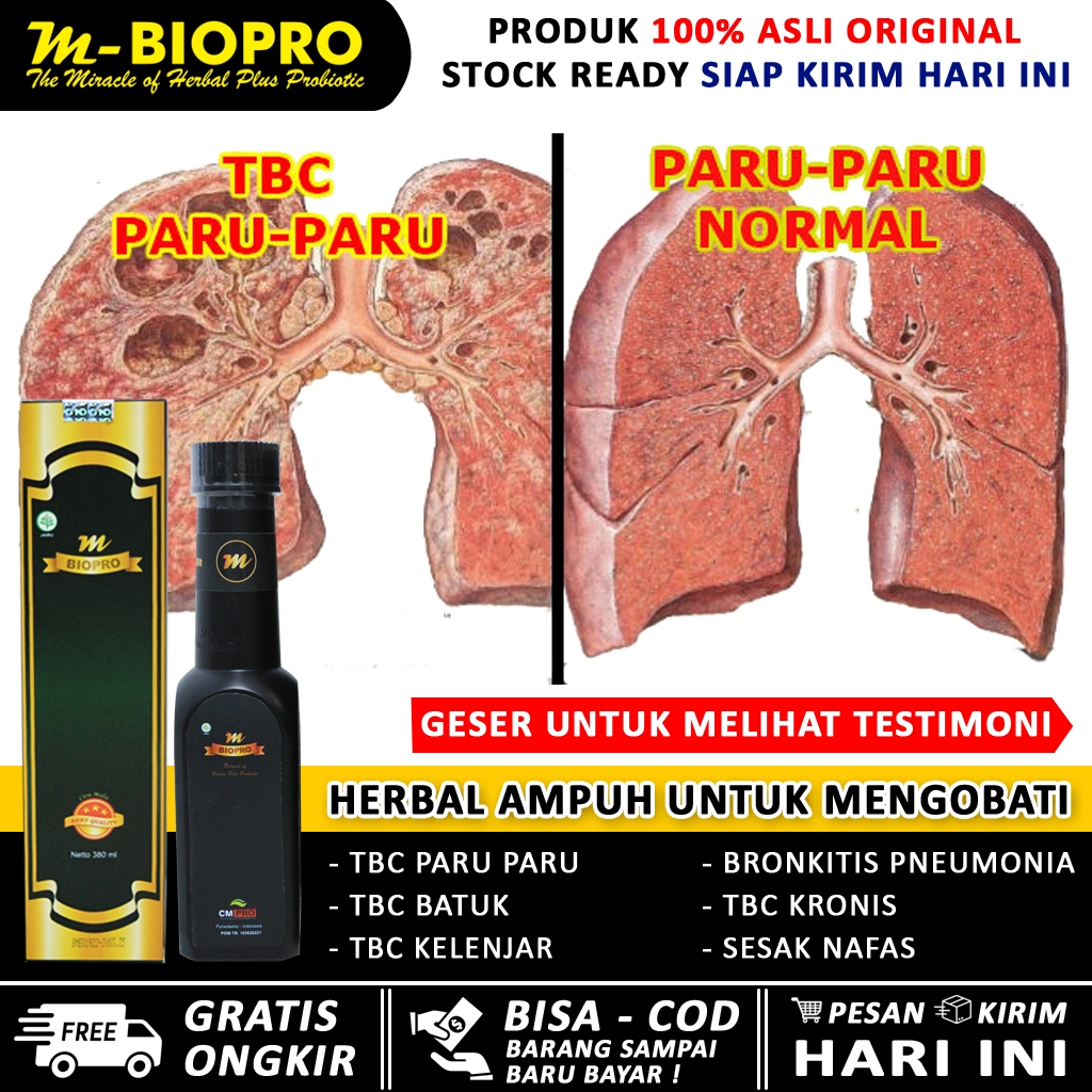 obat tbc paru paru paling ampuh MBIOPRO/ herbal tbc anak dan dewasa tanpa operasi/ tbc paru merah 6 