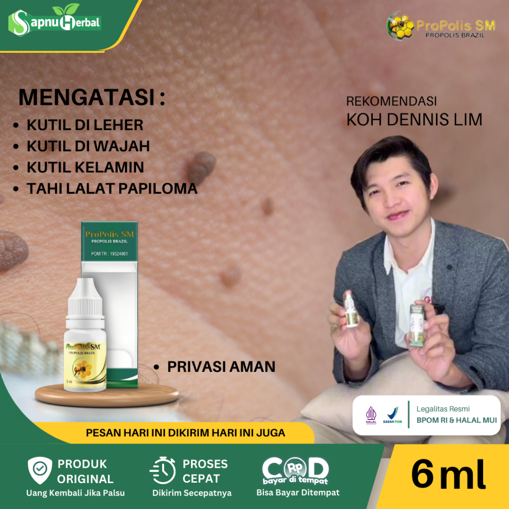 Obat Oles Perontok Kutil Di Leher, Obat Kutil Di Leher, Obat Penghilang Kutil, Obat Daging Tumbuh, O