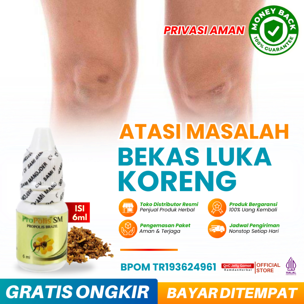 Penghilang Bekas Luka Koreng Koreng Di Lutut Penghilang Bekas Luka Hitam Korengan Bekas Luka Menahun