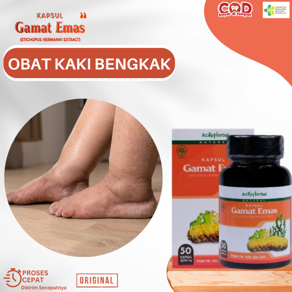 Obat Kaki Bengkak, Obat Bengkak Pada Kaki, Obat Kaki Bengkak Asam Urat, Obat Kaki Bengkak Dan Nyeri,