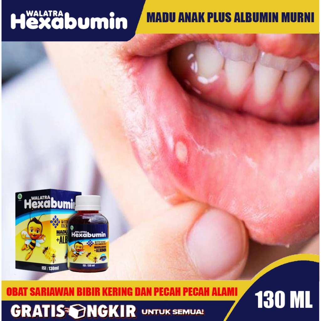 Obat sariawan anak obat sariawan bibir pecah pecah  obat sariawan di bibir alami Hexabumin Albumin 1