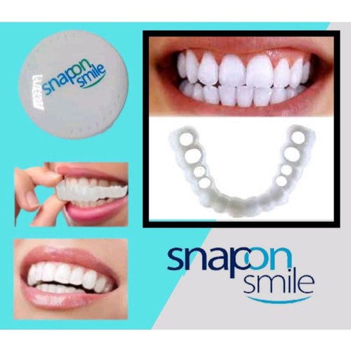 Snap On Smile Veneer Instan Gigi Palsu Tiruan Kesehatan Mulut Mouth Ok