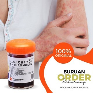 SALEP BISUL ICHTYOL 15G ORIGINAL